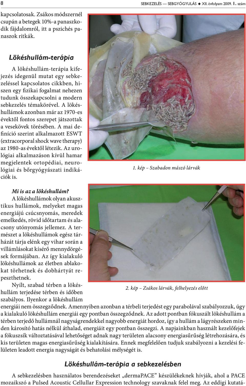 A lökéshullámok azonban már az 1970-es évektől fontos szerepet játszottak a vesekövek törésében. A mai definíció szerint alkalmazott ESWT (extracorporal shock wave therapy) az 1980-as évektől létezik.