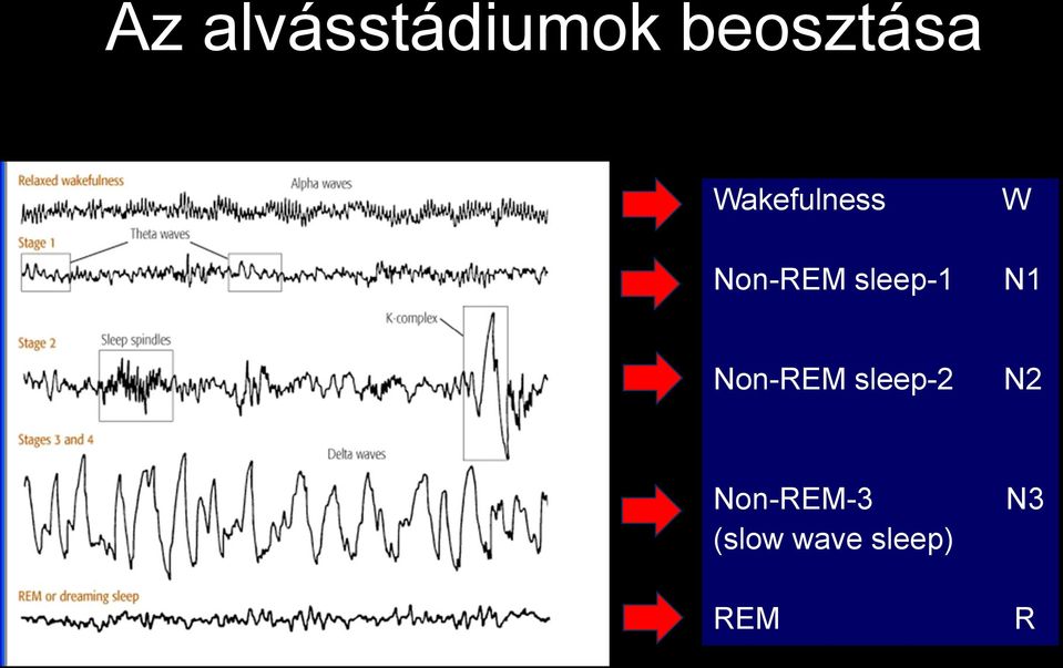 W N1 Non-REM sleep-2 N2