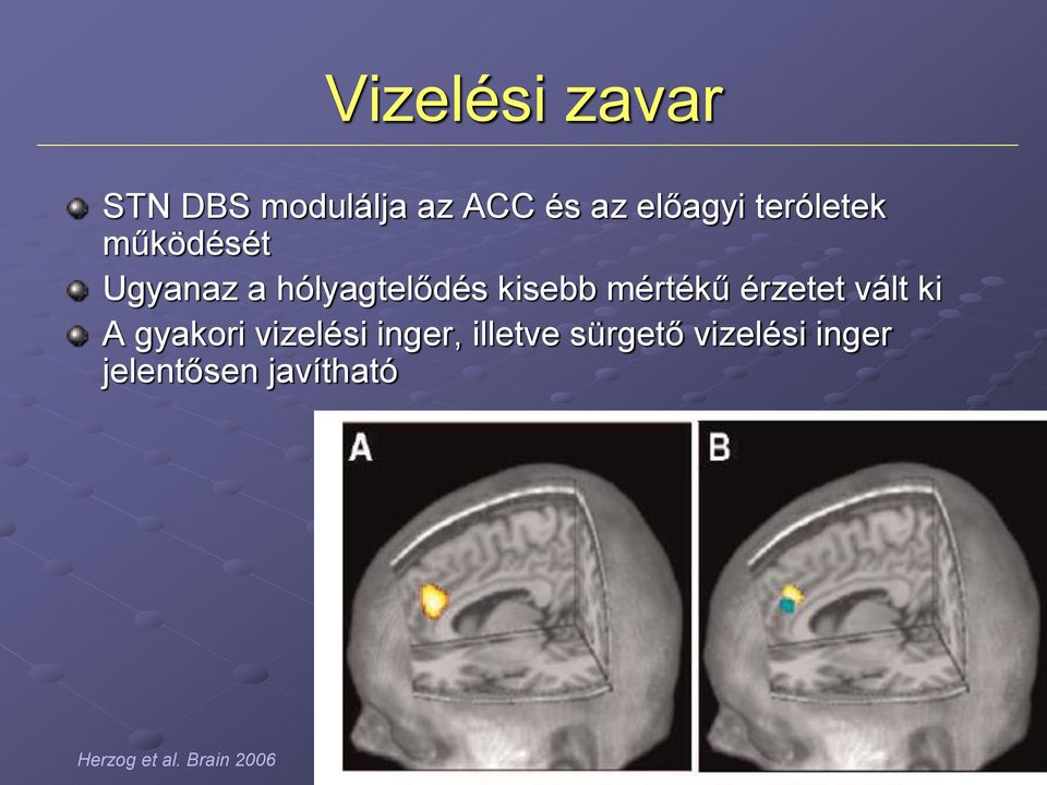 mértékű érzetet vált ki A gyakori vizelési inger, illetve