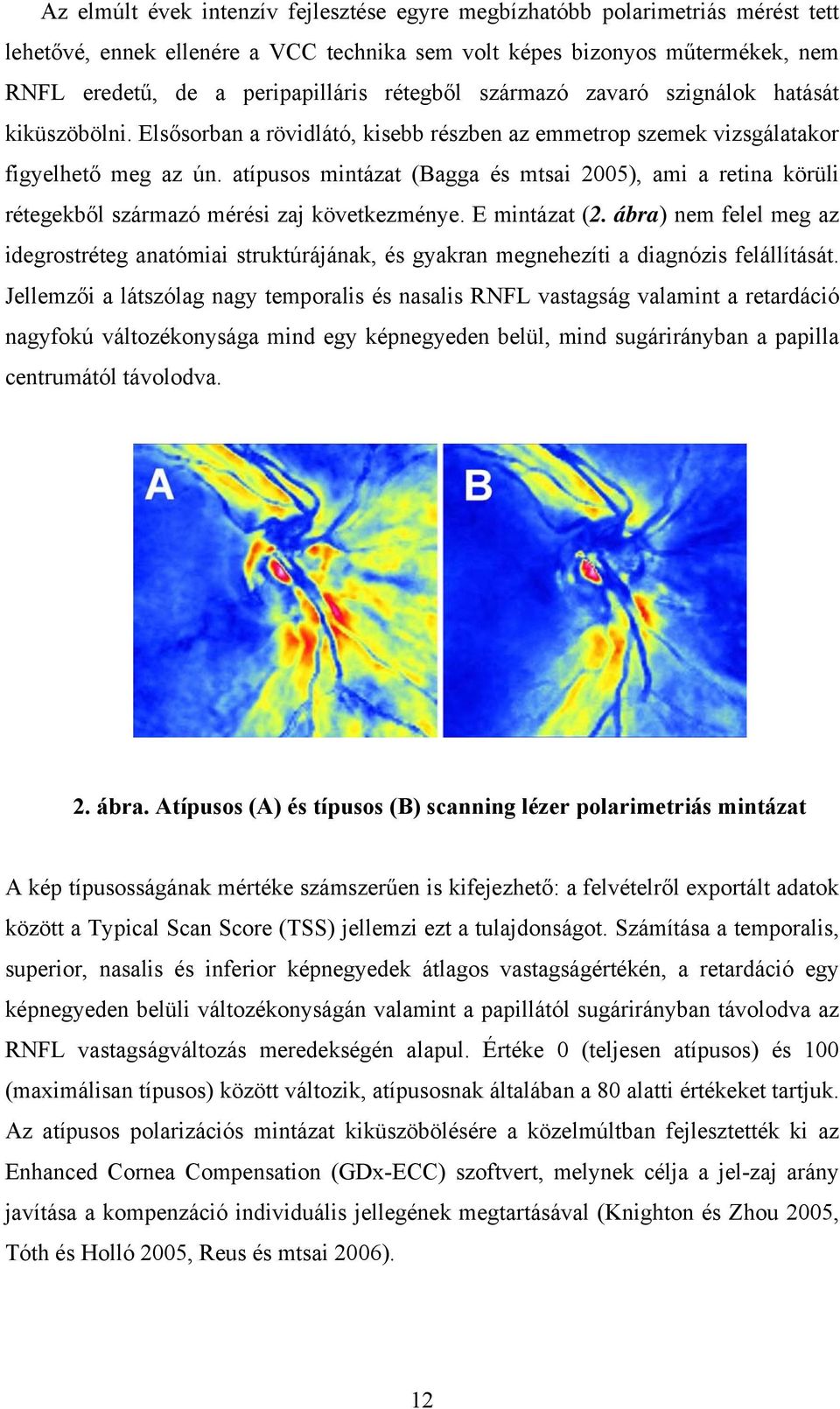 atípusos mintázat (Bagga és mtsai 2005), ami a retina körüli rétegekből származó mérési zaj következménye. E mintázat (2.