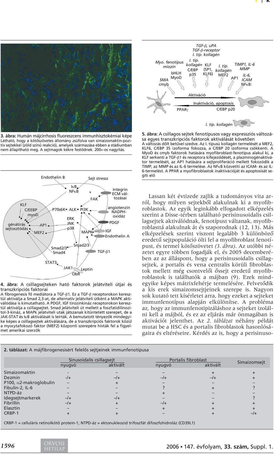 ábra: Humán májcirrhosis fluoreszcens immunhisztokémiai képe Látható, hogy a kötôszövetes állomány zsúfolva van simaizomaktin-pozitív sejtekkel (zöld színû reakció), amelyek származása ebben a