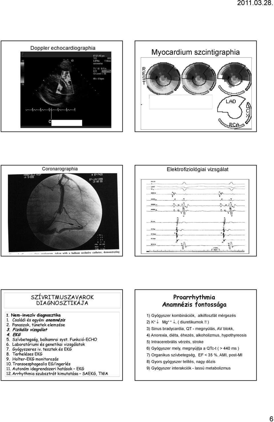Holter-EKG monitorozás 10. Transoesphagealis EG/ingerlés 11. Autonóm idegrendszeri hatások EKG 12.