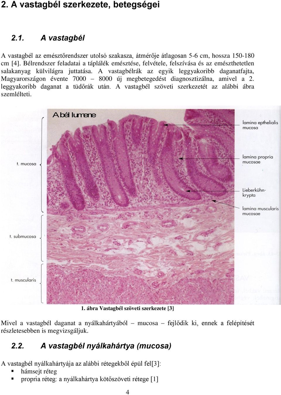 A vastagbélrák az egyik leggyakoribb daganatfajta, Magyarországon évente 7000 8000 új megbetegedést diagnosztizálna, amivel a 2. leggyakoribb daganat a tüdőrák után.