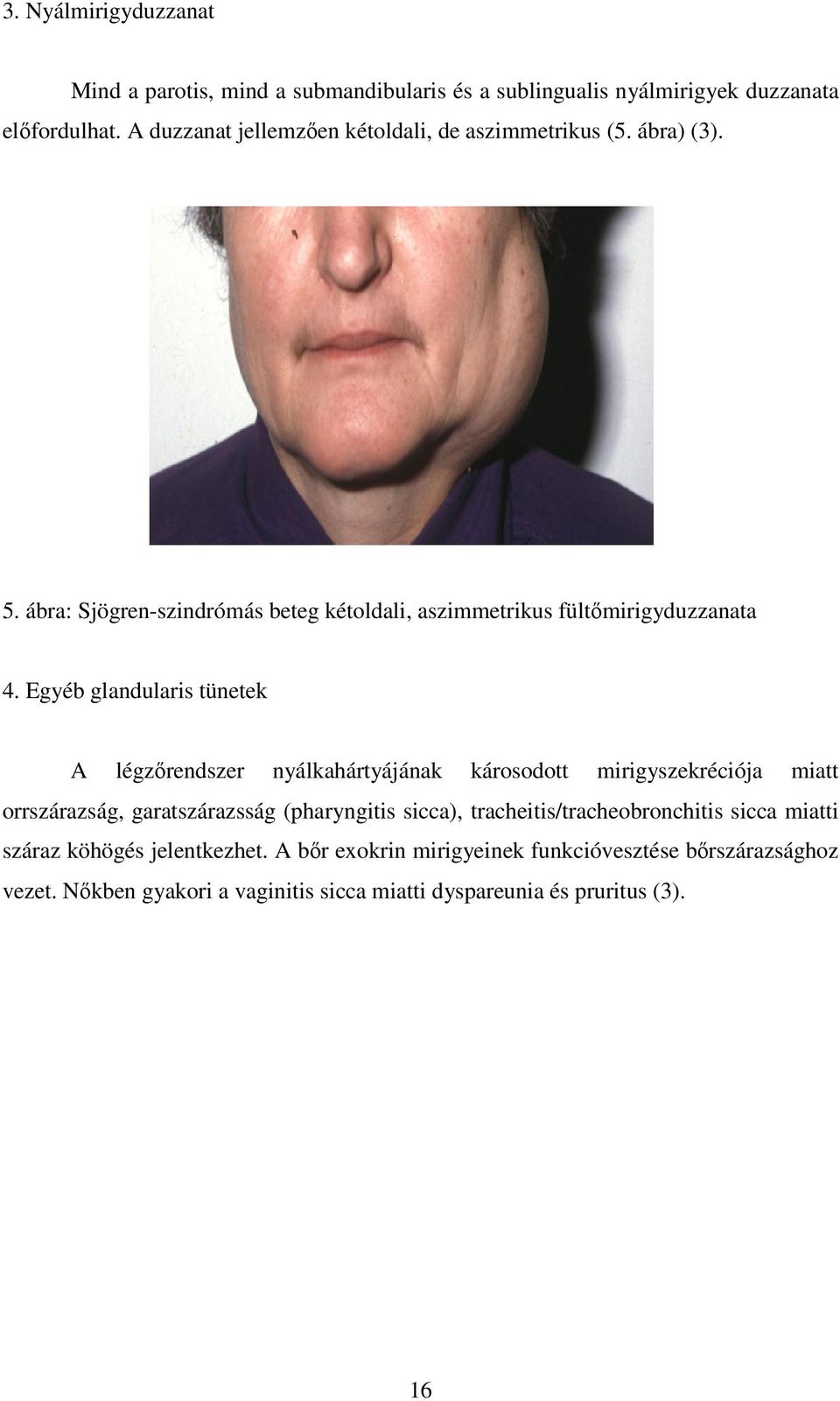 Egyéb glandularis tünetek A légzırendszer nyálkahártyájának károsodott mirigyszekréciója miatt orrszárazság, garatszárazsság (pharyngitis sicca),