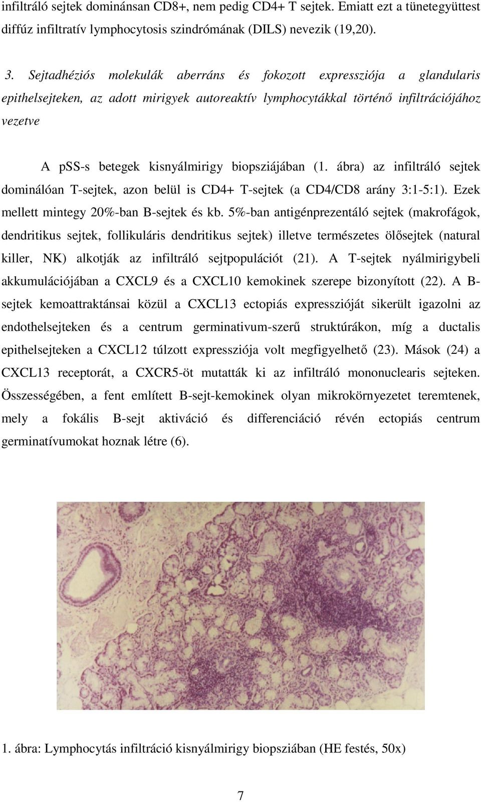 biopsziájában (1. ábra) az infiltráló sejtek dominálóan T-sejtek, azon belül is CD4+ T-sejtek (a CD4/CD8 arány 3:1-5:1). Ezek mellett mintegy 20%-ban B-sejtek és kb.