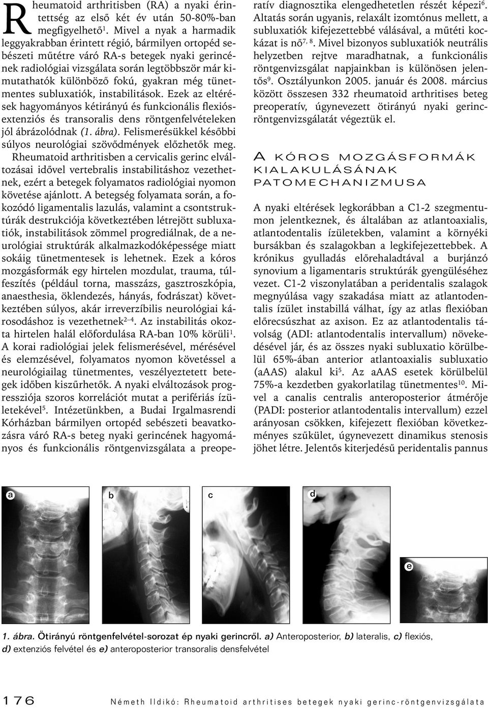 gyakran még tünetmentes subluxatiók, instabilitások. Ezek az eltérések hagyományos kétirányú és funkcionális flexiósextenziós és transoralis dens röntgenfelvételeken jól ábrázolódnak (1. ábra).