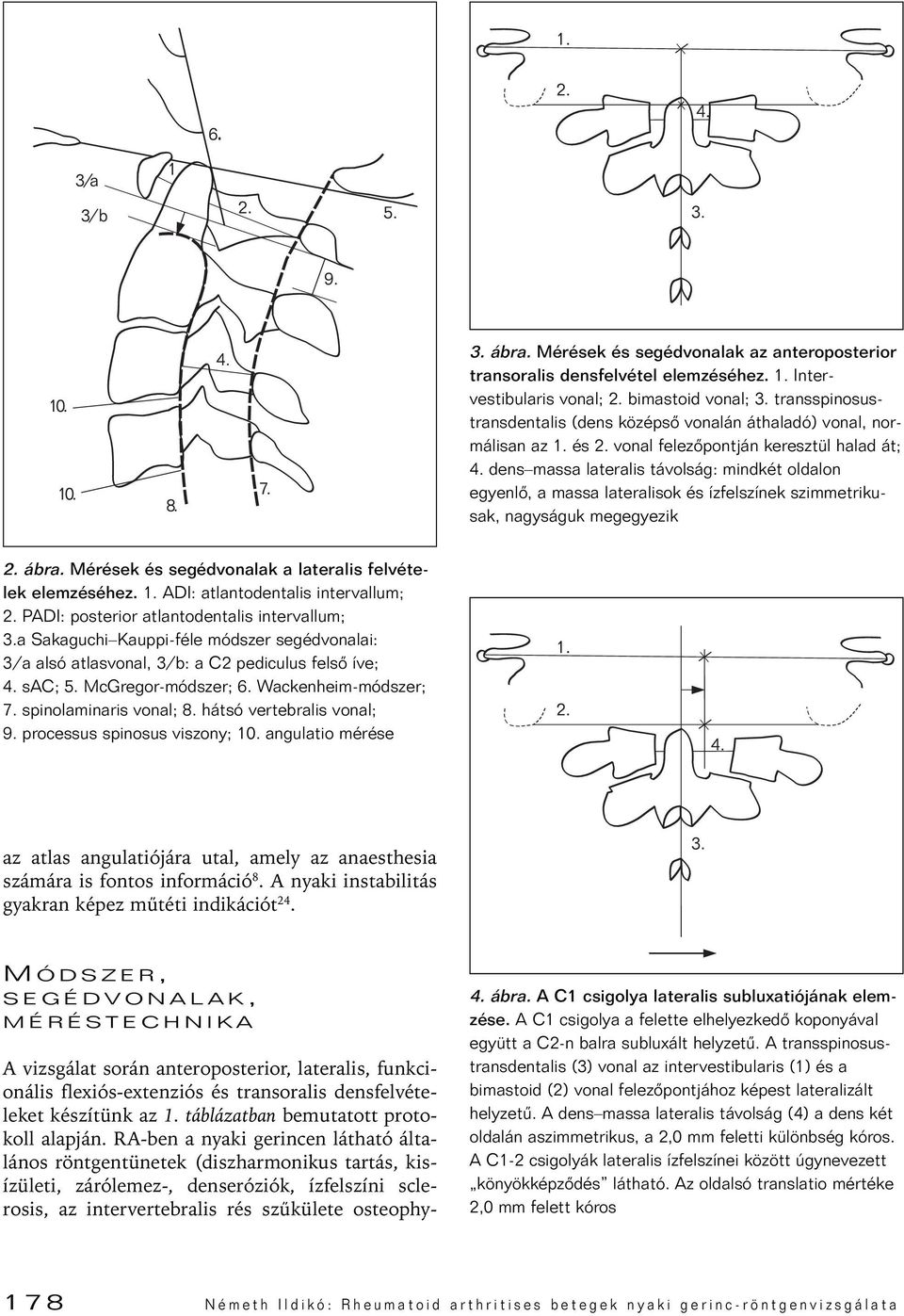 dens massa lateralis távolság: mindkét oldalon egyenlô, a massa lateralisok és ízfelszínek szimmetrikusak, nagyságuk megegyezik 2. ábra. Mérések és segédvonalak a lateralis felvételek elemzéséhez. 1.