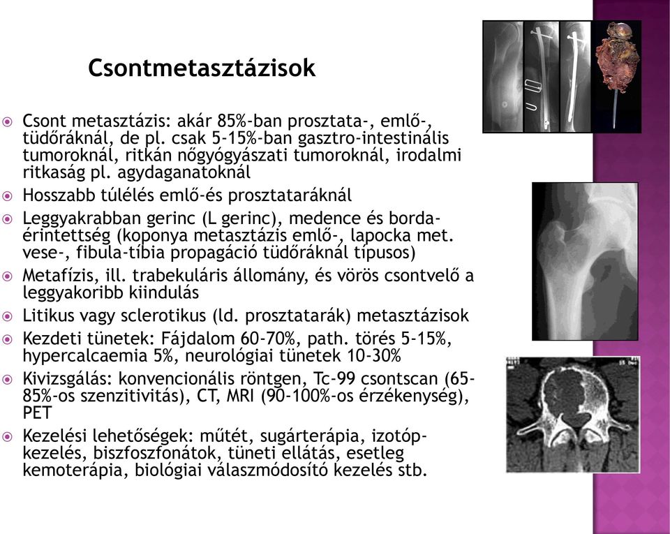 vese-, fibula-tíbia propagáció tüdőráknál típusos) Metafízis, ill. trabekuláris állomány, és vörös csontvelő a leggyakoribb kiindulás Litikus vagy sclerotikus (ld.