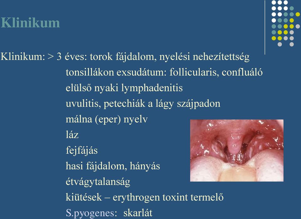 uvulitis, petechiák a lágy szájpadon málna (eper) nyelv láz fejfájás hasi