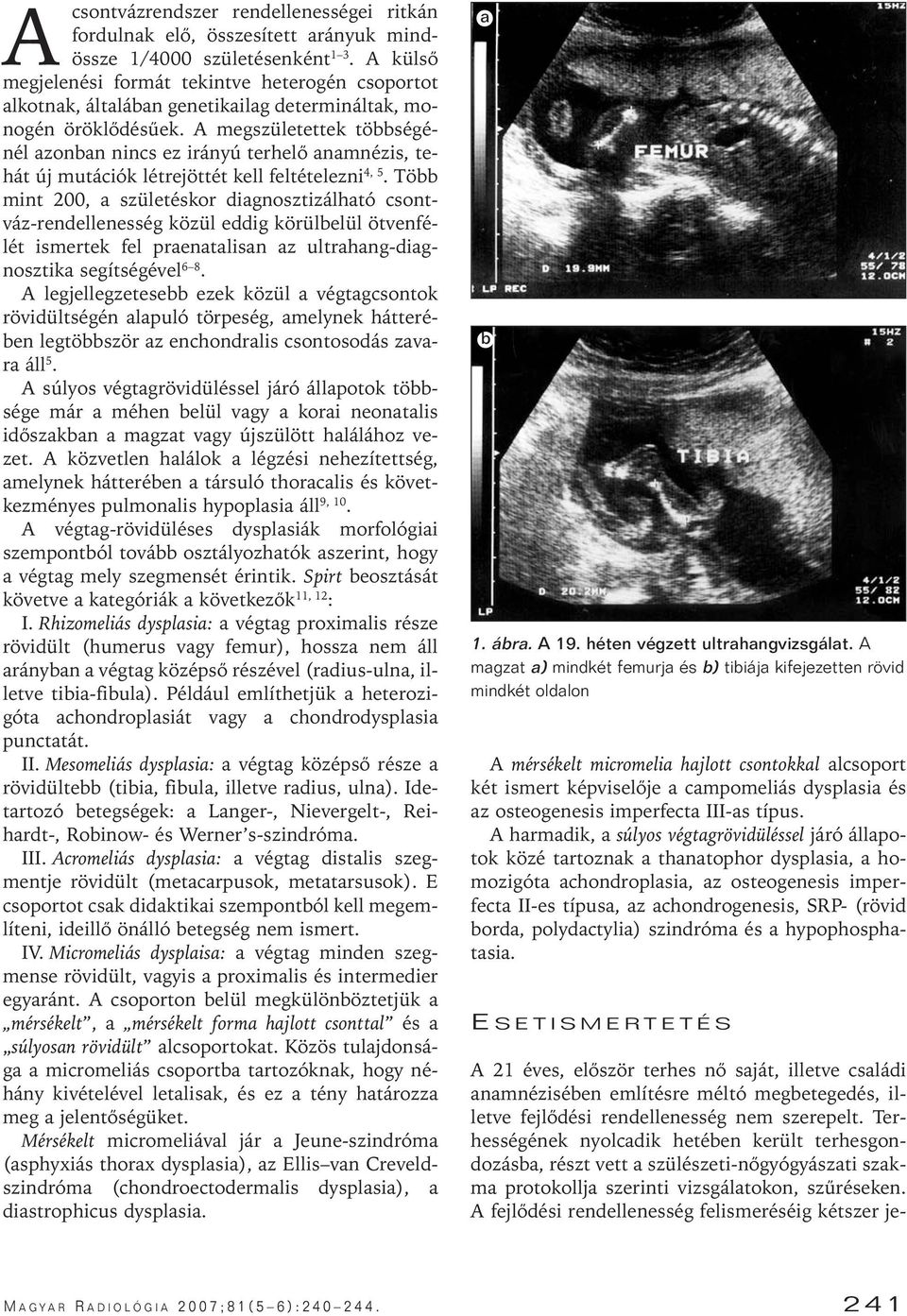 A megszületettek többségénél azonban nincs ez irányú terhelô anamnézis, tehát új mutációk létrejöttét kell feltételezni 4, 5.