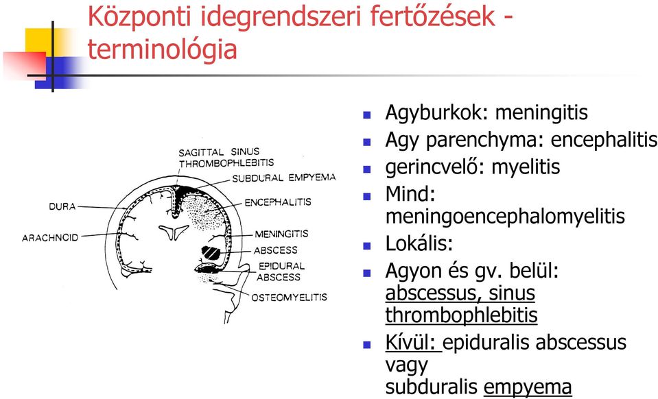 meningoencephalomyelitis Lokális: Agyon és gv.