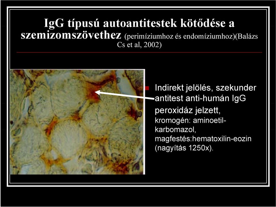 jelölés, szekunder antitest anti-humán IgG peroxidáz jelzett,