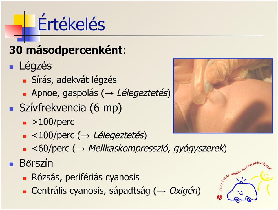 ( Lélegeztetés) <60/perc ( Mellkaskompresszió, gyógyszerek)