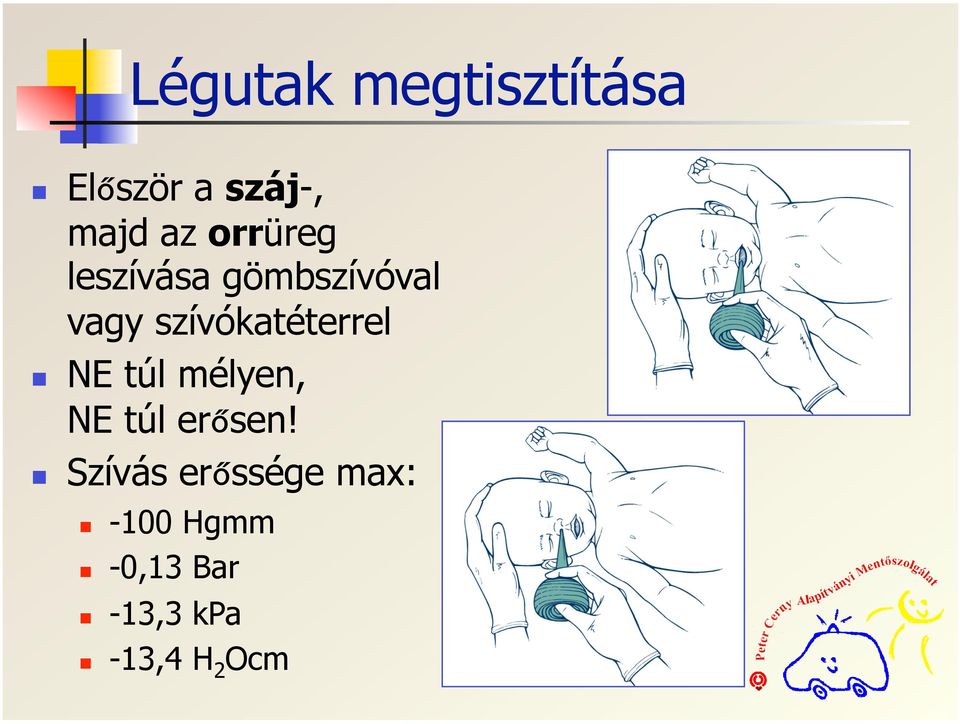 szívókatéterrel NE túl mélyen, NE túl erősen!