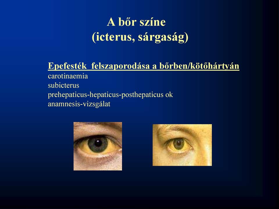 bőrben/kötőhártyán carotinaemia