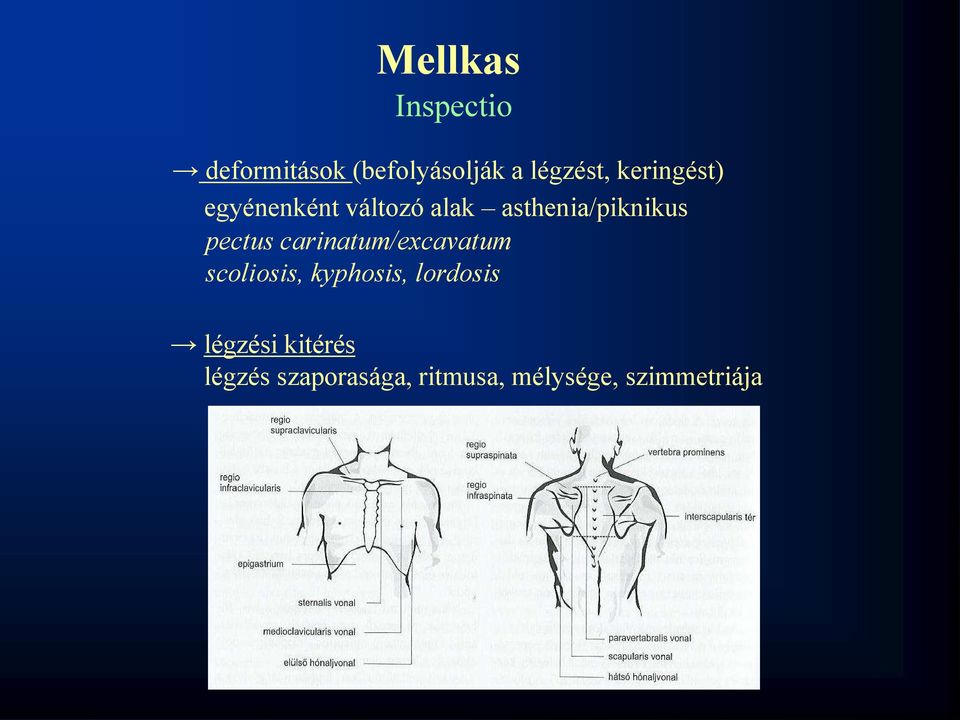 pectus carinatum/excavatum scoliosis, kyphosis, lordosis