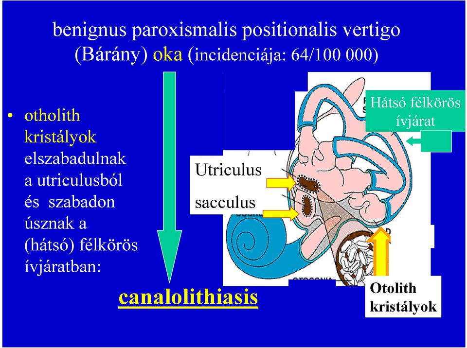 úsznak a (hátsó) félkörös ívjáratban: Utriculus sacculus tttttttttttttt