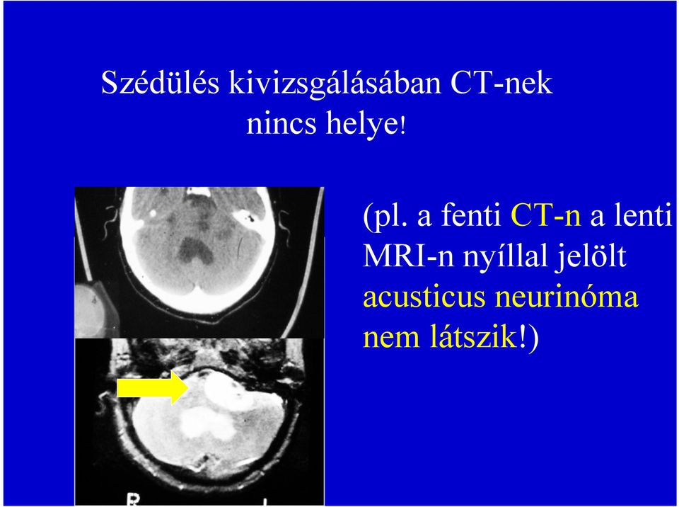 a fenti CT-n a lenti MRI-n