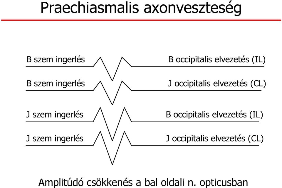 ingerlés J szem ingerlés B occipitalis elvezetés (IL) J