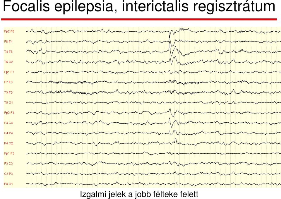 regisztrátum