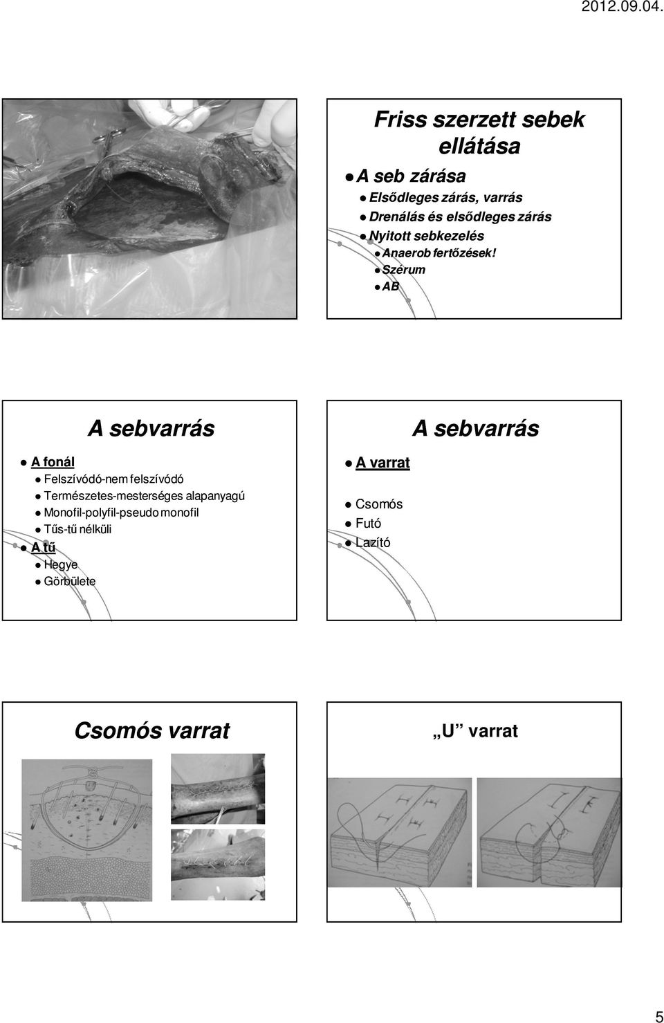 Szérum AB A sebvarrás A fonál Felszívódó-nem felszívódó Természetes-mesterséges mesterséges