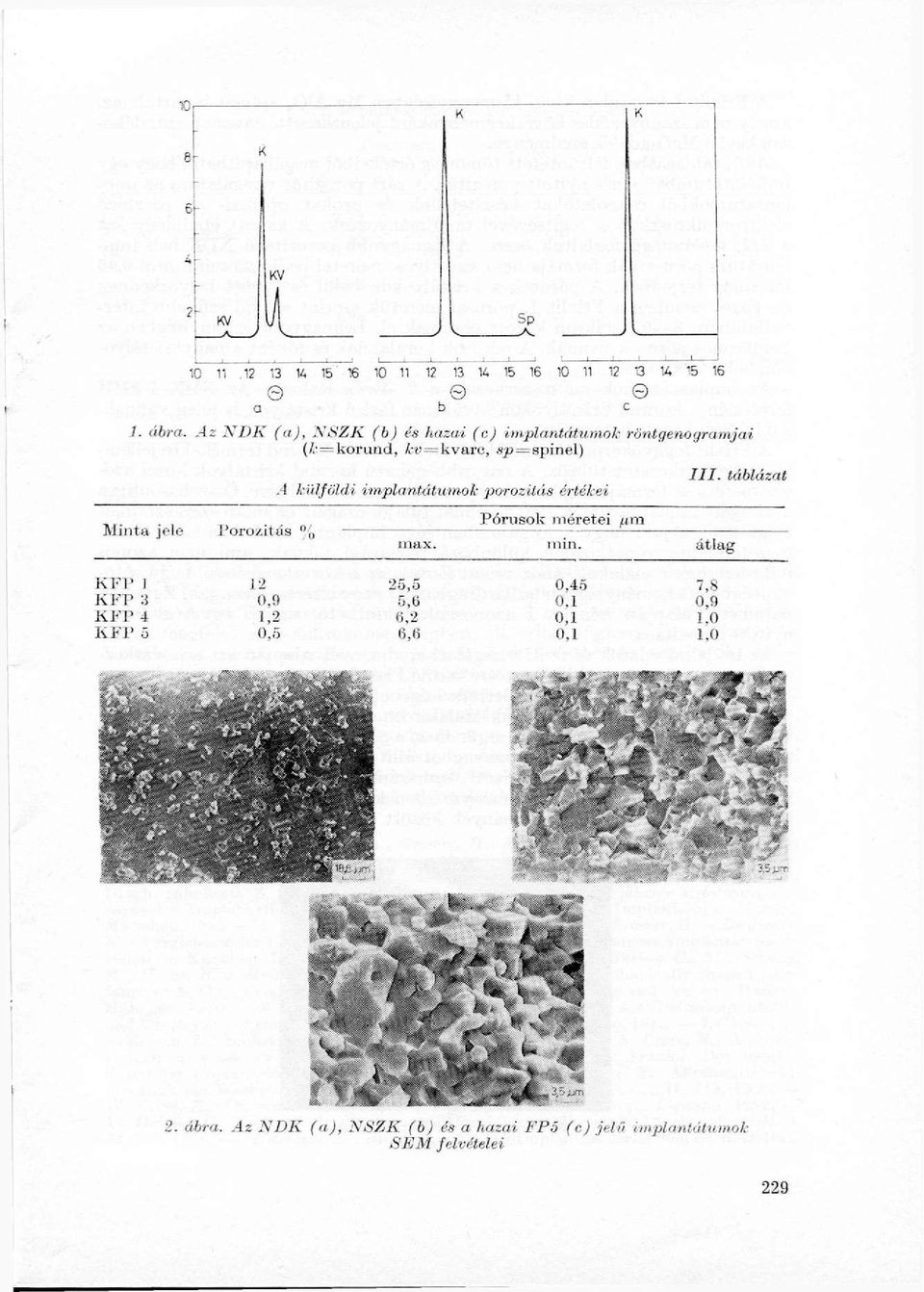 ' = korund, u = kvarc, sjo = spinel) A külföldi implantátumok porozitás értékei III.