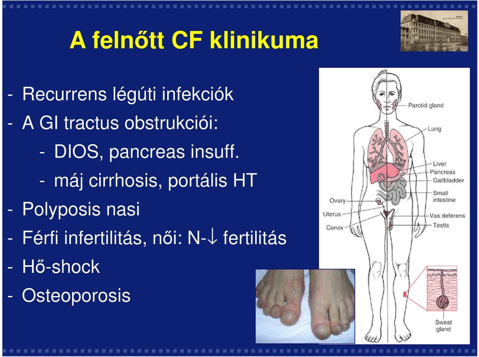 - máj cirrhosis, portális HT - Polyposis nasi - Férfi