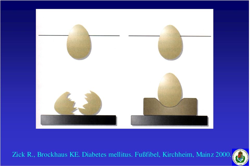 Diabetes mellitus.