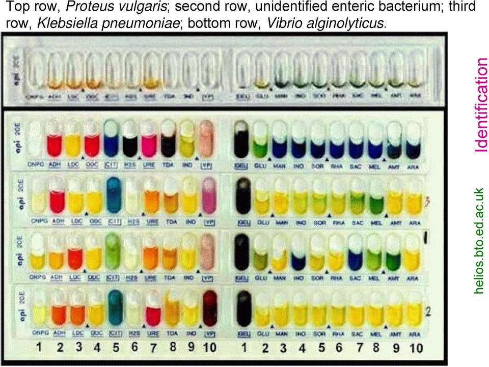 Klebsiella pneumoniae; bottom row, Vibrio