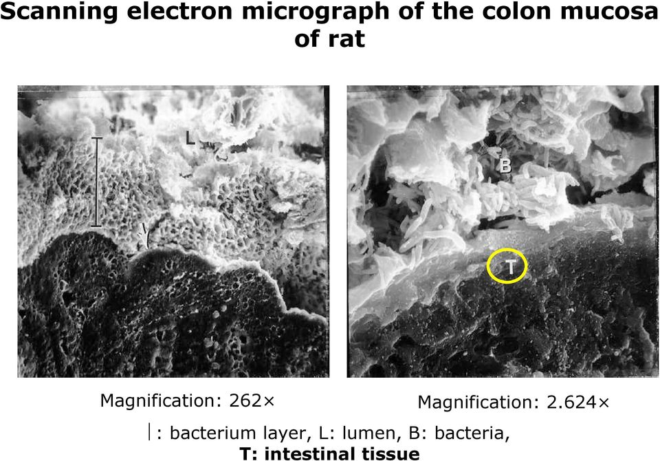 Magnification: 2.