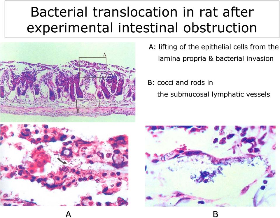 the epithelial cells from the lamina propria &