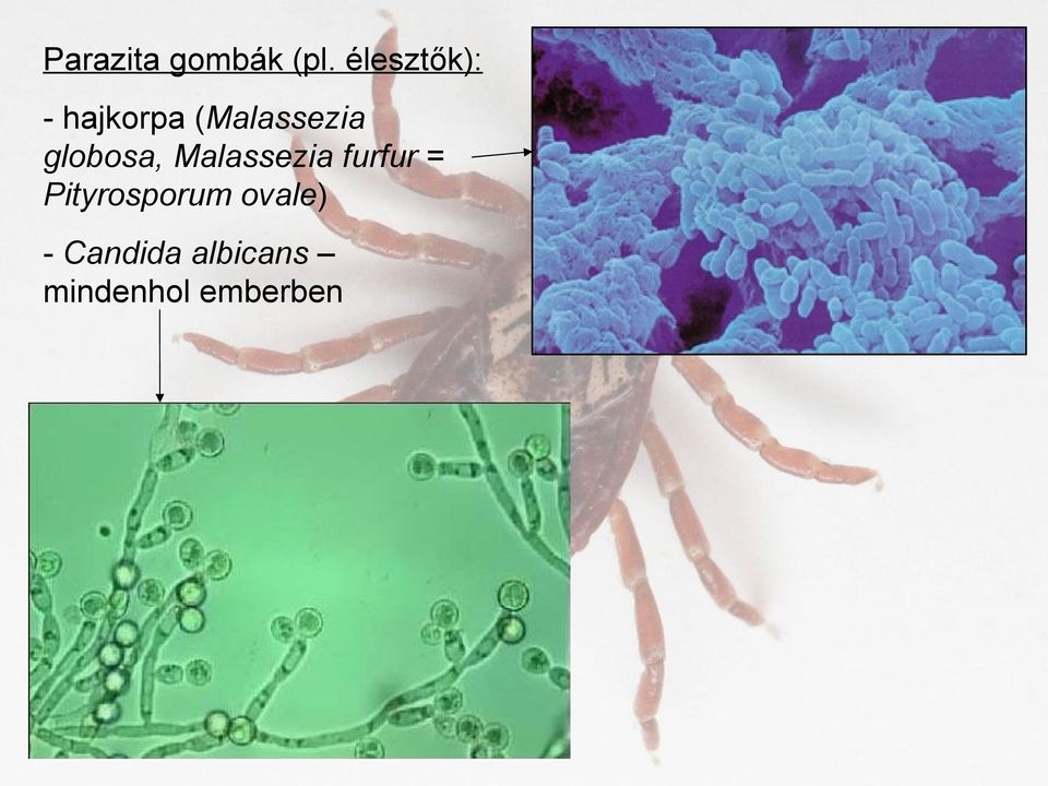 globosa, Malassezia furfur =