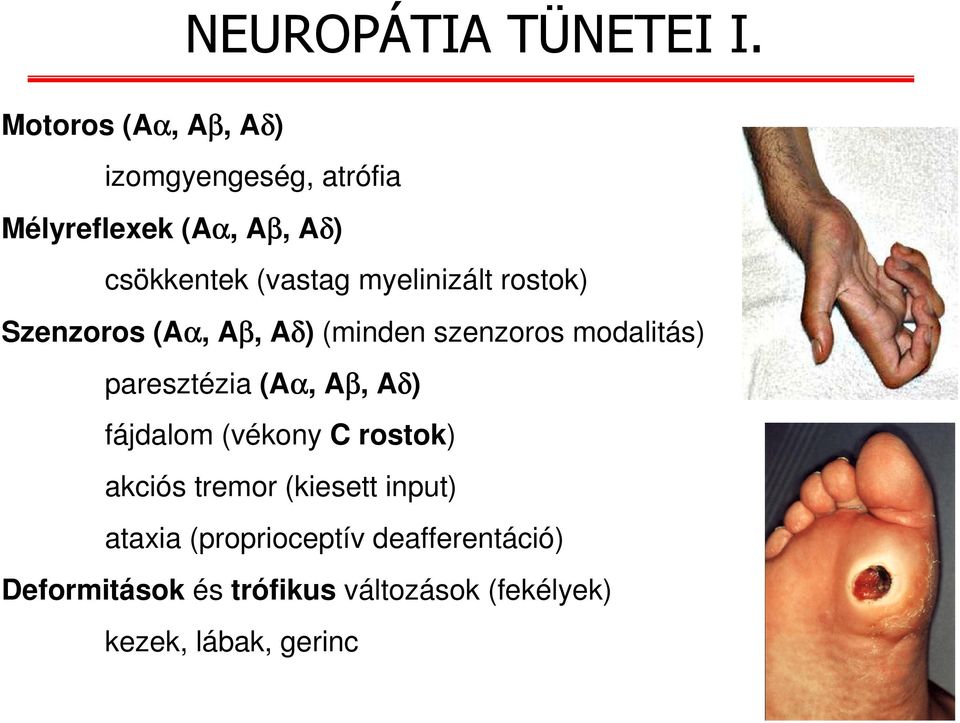 myelinizált rostok) Szenzoros (Aα, Aβ, Aδ) (minden szenzoros modalitás) paresztézia (Aα, Aβ,