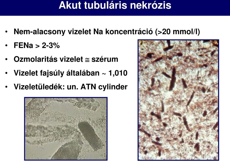 Ozmolaritás vizelet szérum Vizelet fajsúly