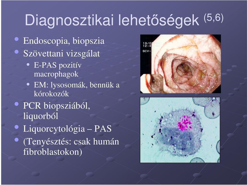 lysosomák, bennük a kórokozók PCR biopsziából,