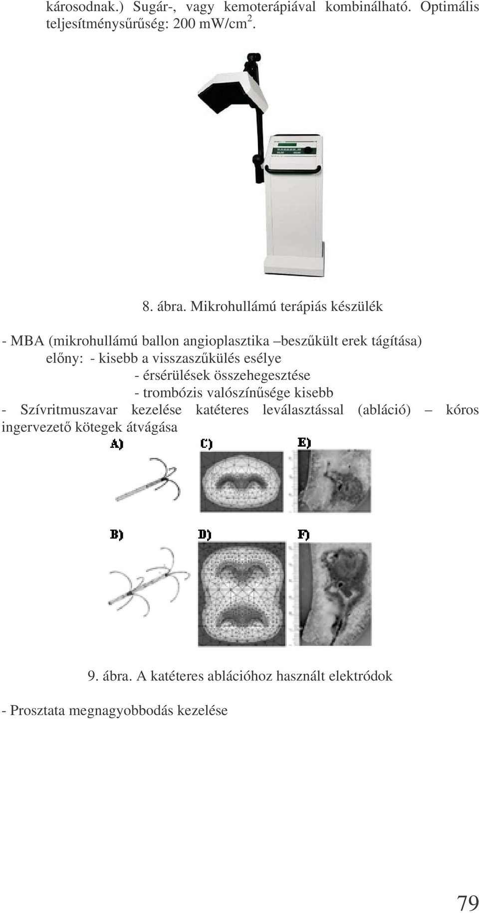 visszaszkülés esélye - érsérülések összehegesztése - trombózis valószínsége kisebb - Szívritmuszavar kezelése katéteres