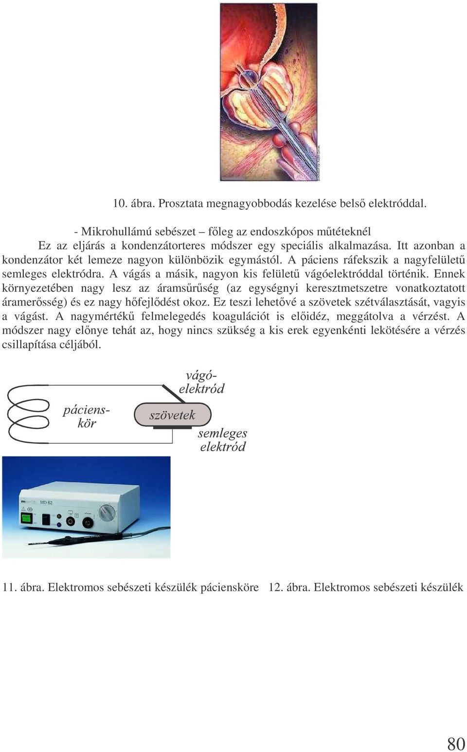 Ennek környezetében nagy lesz az áramsrség (az egységnyi keresztmetszetre vonatkoztatott áramersség) és ez nagy hfejldést okoz. Ez teszi lehetvé a szövetek szétválasztását, vagyis a vágást.