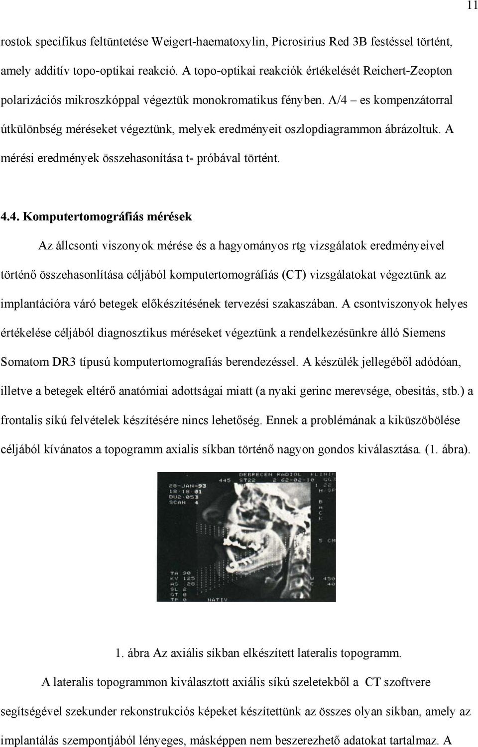 /4 es kompenzátorral útkülönbség méréseket végeztünk, melyek eredményeit oszlopdiagrammon ábrázoltuk. A mérési eredmények összehasonítása t- próbával történt. 4.4. Komputertomográfiás mérések Az