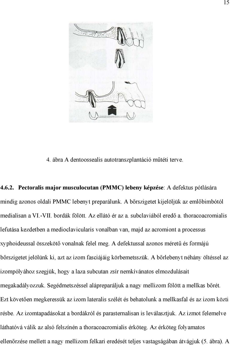 thoracoacromialis lefutása kezdetben a medioclavicularis vonalban van, majd az acromiont a processus xyphoideussal összeköt vonalnak felel meg.