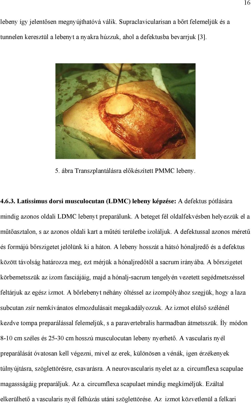A beteget fél oldalfekvésben helyezzük el a m t asztalon, s az azonos oldali kart a m téti területbe izoláljuk. A defektussal azonos méret és formájú b rszigetet jelölünk ki a háton.