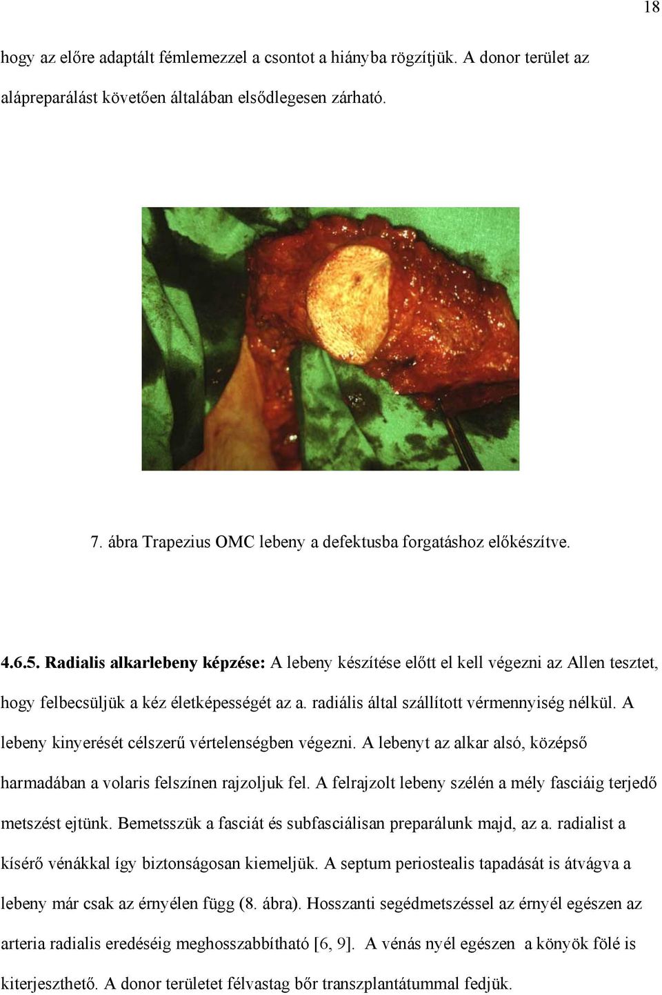 Radialis alkarlebeny képzése: A lebeny készítése el tt el kell végezni az Allen tesztet, hogy felbecsüljük a kéz életképességét az a. radiális által szállított vérmennyiség nélkül.