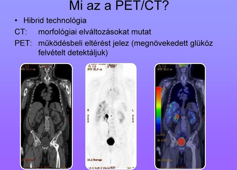 morfológiai elváltozásokat mutat