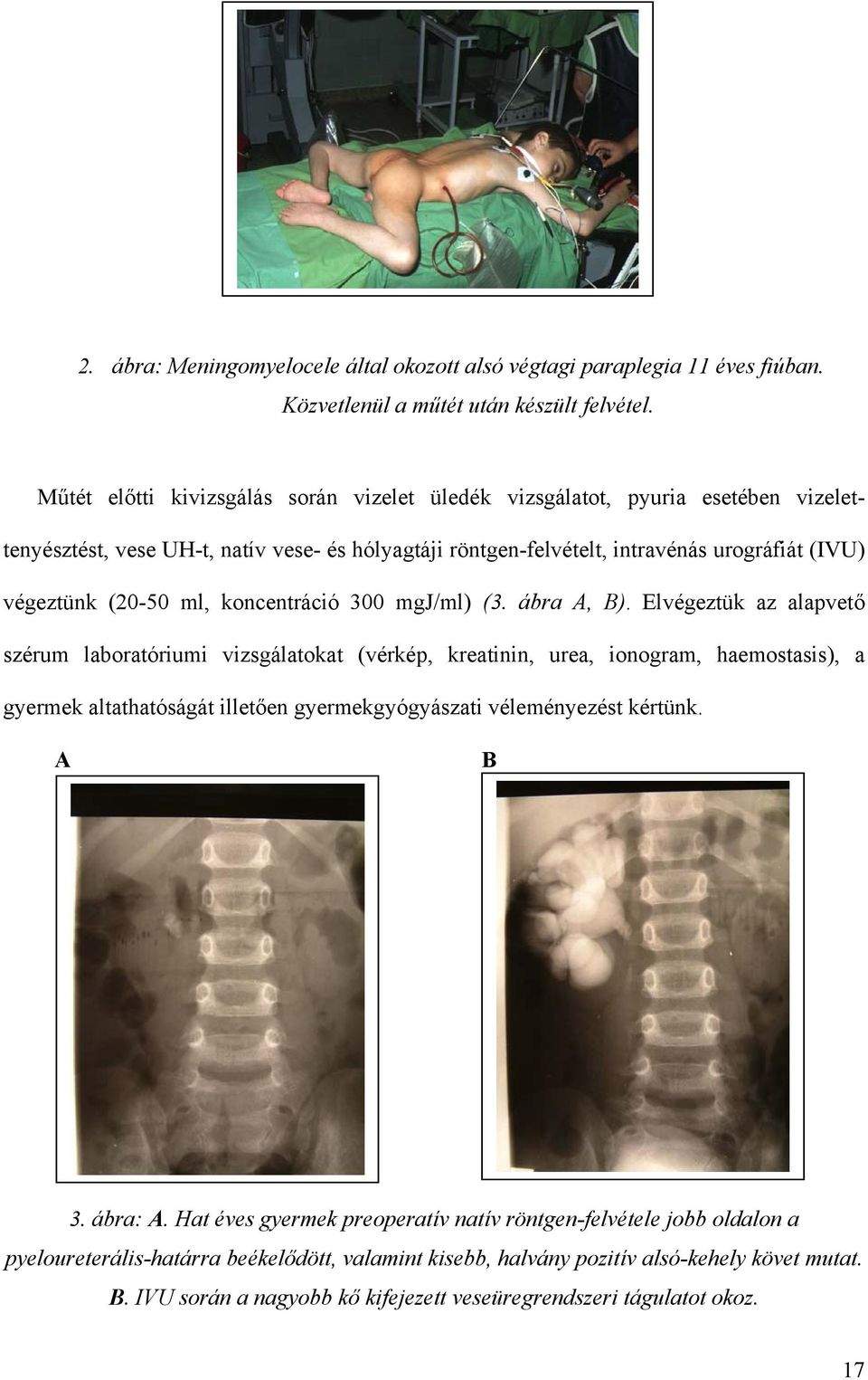 koncentráció 300 mgj/ml) (3. ábra A, B).