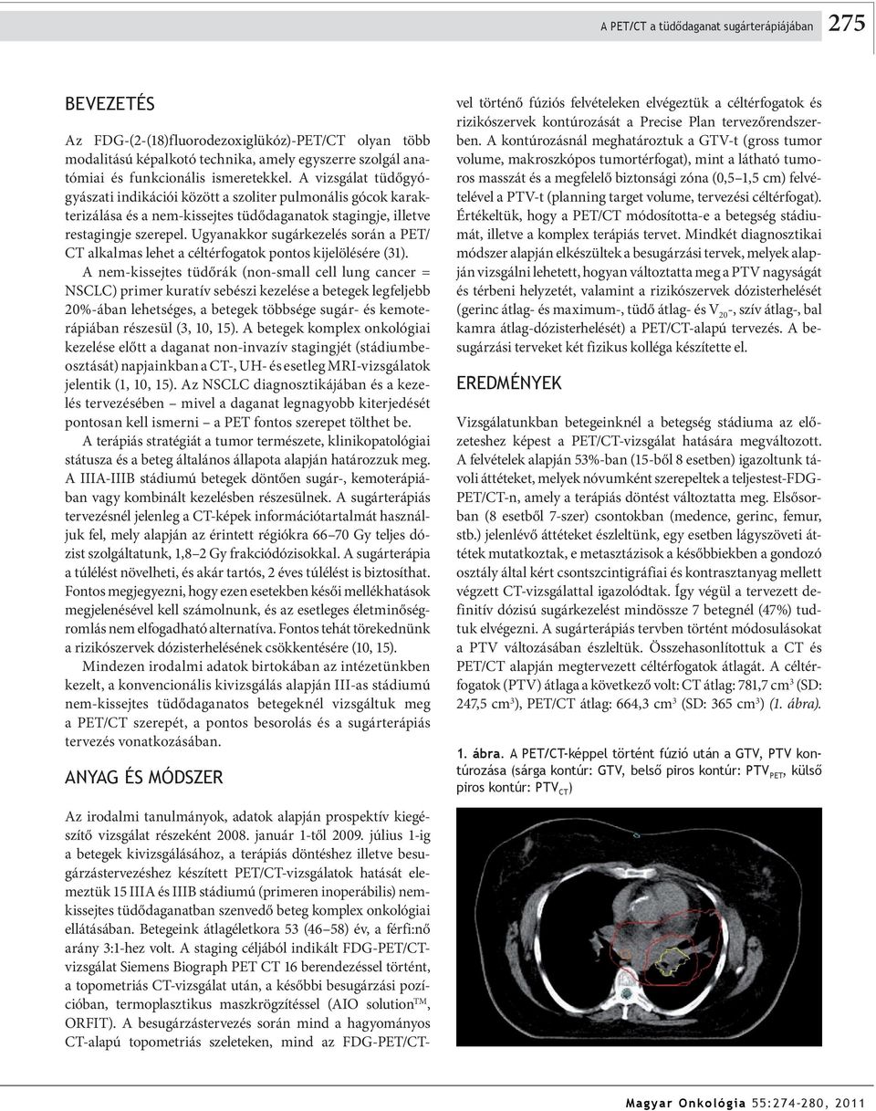 Ugyanakkor sugárkezelés során a PET/ CT alkalmas lehet a céltérfogatok pontos kijelölésére (31).