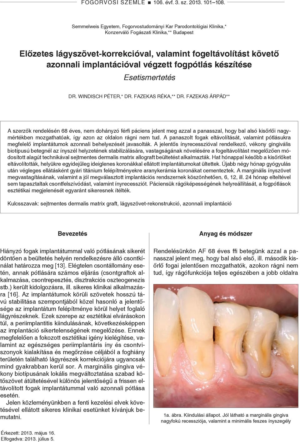 végzett fogpótlás készítése Esetismertetés Dr. Windisch Péter,* Dr. Fazekas Réka,** Dr.