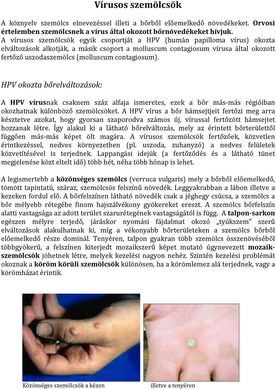 contagiosum). HPV okozta bőrelváltozások: A HPV vírusnak csaknem száz alfaja ismeretes, ezek a bőr más-más régióiban okozhatnak különböző szemölcsöket.