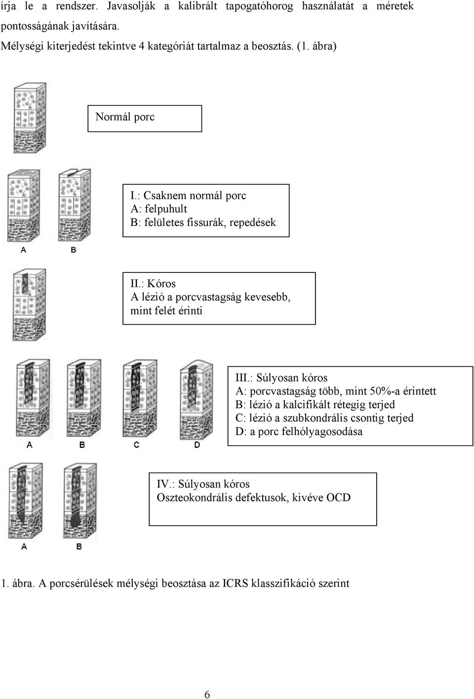 : Csaknem normál porc A: felpuhult B: felületes fissurák, repedések II.: Kóros A lézió a porcvastagság kevesebb, mint felét érinti III.