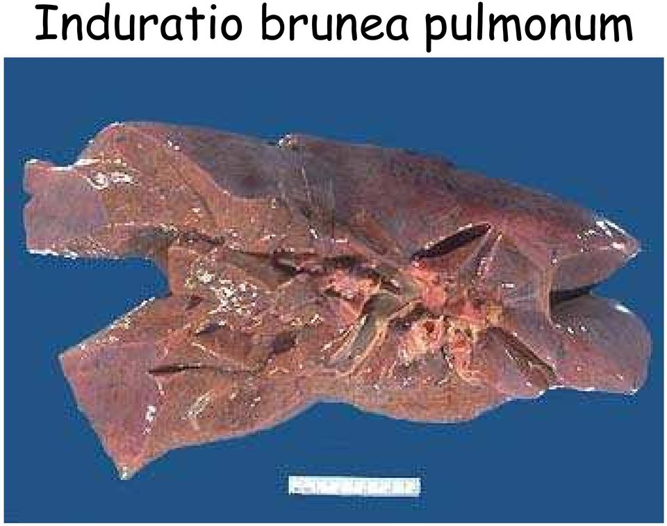 pulmonum