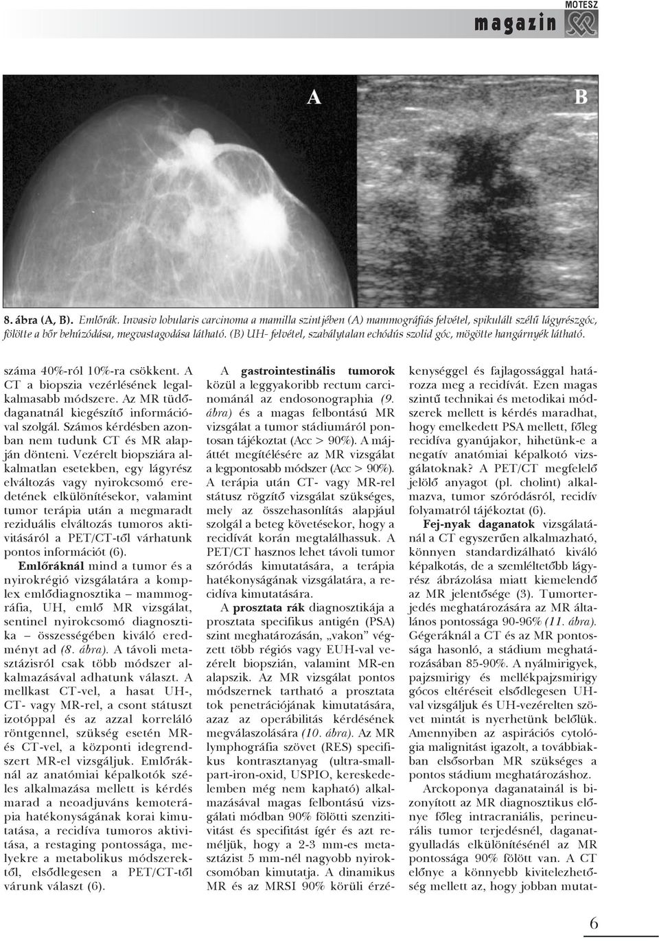 Az MR tüdõdaganatnál kiegészítõ információval szolgál. Számos kérdésben azonban nem tudunk CT és MR alapján dönteni.