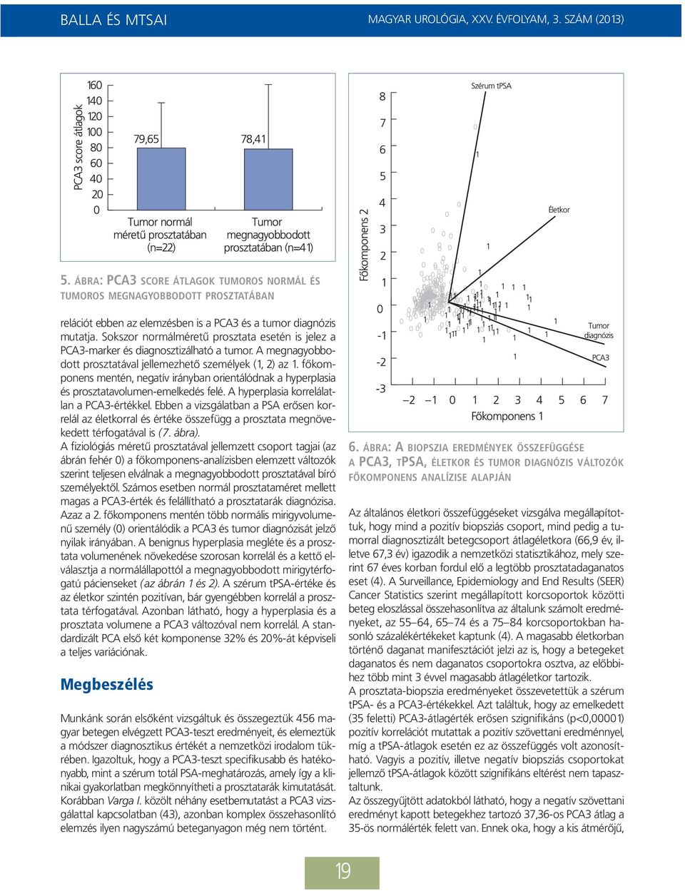 fõ kom - ponens mentén, negatív irányban orientálódnak a hyperplasia és prosztatavolumen-emelkedés felé. A hyperplasia korrelálatlan a PCA3-értékkel.
